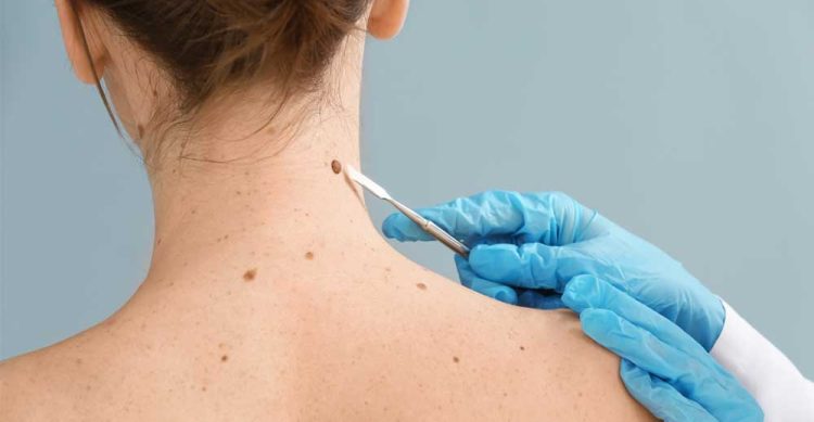 Patite chirurgie dermatologique aux Centres Cosem